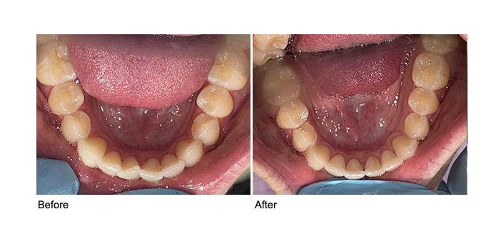 before after image